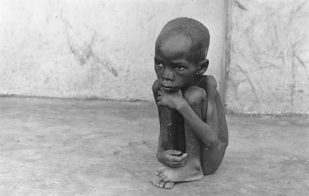 Голодающий ребенок в Биафре / Getty Images